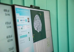 Разработка российских ученых поможет быстро выявить болезни головного мозга 